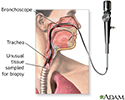Upper airway test