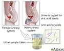 Uric acid test