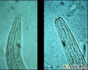 Hookworm - mouth of the organism