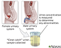 Urine concentration test