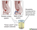 Osmolality test