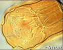 Hookworm - close-up of the organism