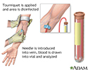 Blood test