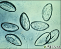 Pinworm eggs