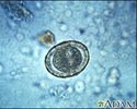 Roundworm eggs - ascariasis