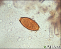 Trichuris trichiura egg