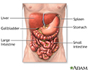 Abdominal exploration - series