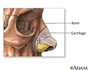 Nose surgery - series