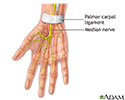 Carpal tunnel repair - Series