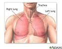 Pulmonary lobectomy - series - Normal anatomy