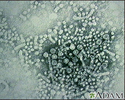 Hepatitis B virus