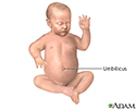 Umbilical hernia repair - series - Normal anatomy