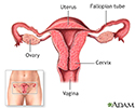 Barrier methods of birth control - Series