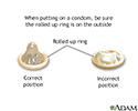 Condom application - series