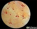 Salmonella typhi organism