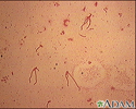 Yersinia enterocolitica organism