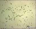 Campylobacter jejuni organism