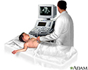 Abdominal ultrasound