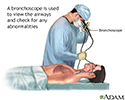 Bronchoscopy