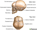 Skull of a newborn
