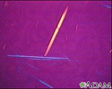 Uric acid crystals