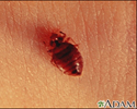 Bedbug - close-up