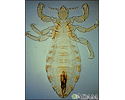 Body louse