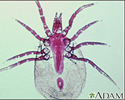 Dust mite