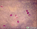 Cryptosporidium - organism