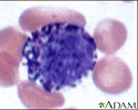 Basophil (close-up)