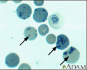Reticulocytes