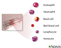 Complete blood count - series - Indication