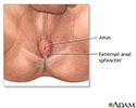 Anal fissure - series