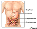 Inflammatory bowel disease - series