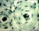 Bone Tissue