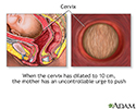 Emergency Childbirth