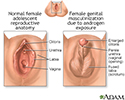 Developmental disorders of the vagina and vulva