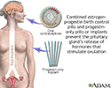 Hormone-based contraceptives