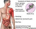 Ebola virus disease