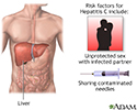Hepatitis C