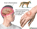 Rabies
