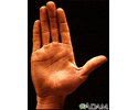 Surface anatomy - normal palm