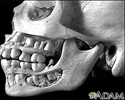 Teeth, adult - in the skull
