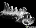 Vertebra, cervical (neck)