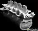 Vertebra, lumbar (low back)
