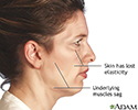 Facelift - series - Indications