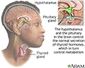 Brain-thyroid link