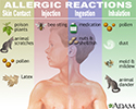 Allergic reactions