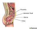 Amniocentesis - series - Indication