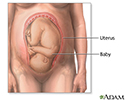 Breech - series